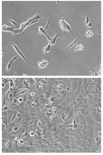 4T1-mNIS-Puro Mammary Carcinoma Cell Line - Imanis Life Sciences