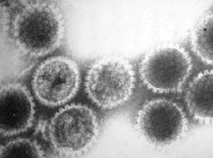 Herpes Simplex Virus