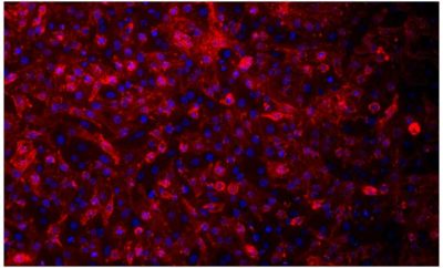 Anti-human NIS VJ1 Immunofluorescence