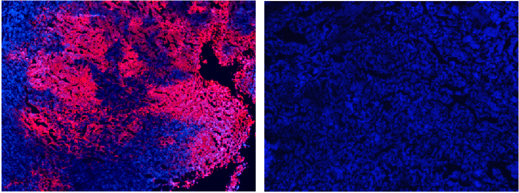 Immunofluorescence Anti-VSV