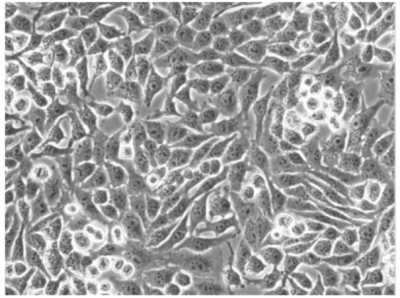 A375-Fluc-Puro Cell Morphology