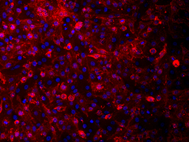 Anti-Human NIS VJ1 Reporter Gene Antibody - Imanis Life Sciences