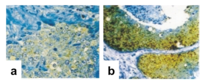 Anti-Human NIS Antibody (monoclonal, affinity purified) Immunohistochemistry