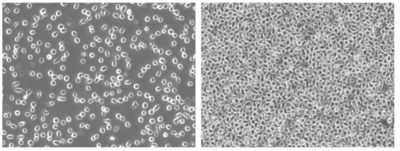 Nalm6-Fluc-hNIS Morphology