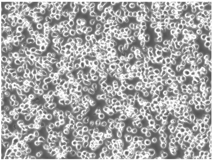 Morphology C1498-Fluc-Puro