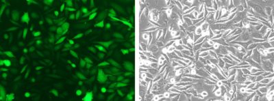 PC3-eGFP-Neo Morphology