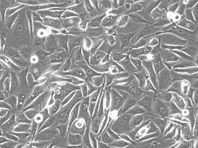 PC3-Fluc-Puro Morphology