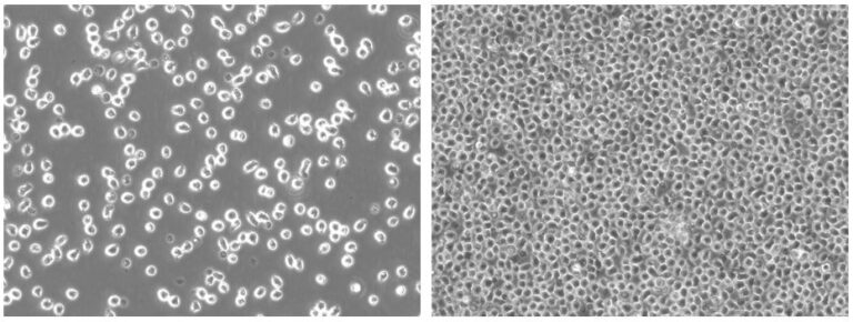 Nalm6-Fluc-Puro Reporter Gene Cell Line